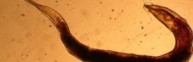 parazit červa z ľudského tela