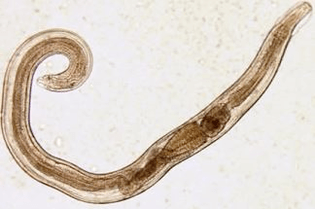 pinworms v ľudskom tele